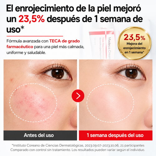 Centellian24 Madeca Cream Time Reverse 50ml – Crema Antiedad Reparadora con TECA y Retinol